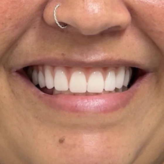 Depois do tratamento odontológico