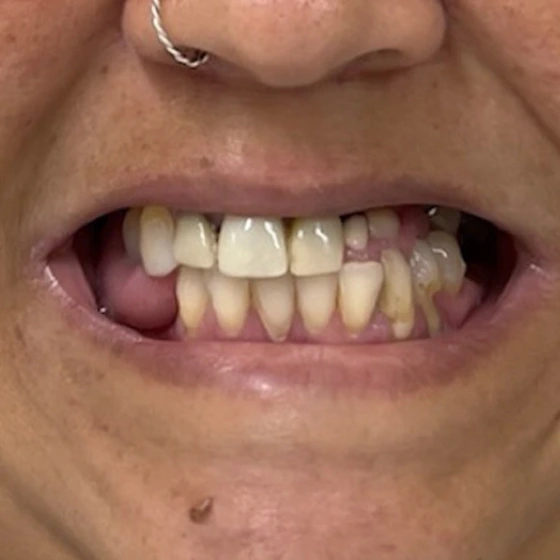 Antes do tratamento odontológico