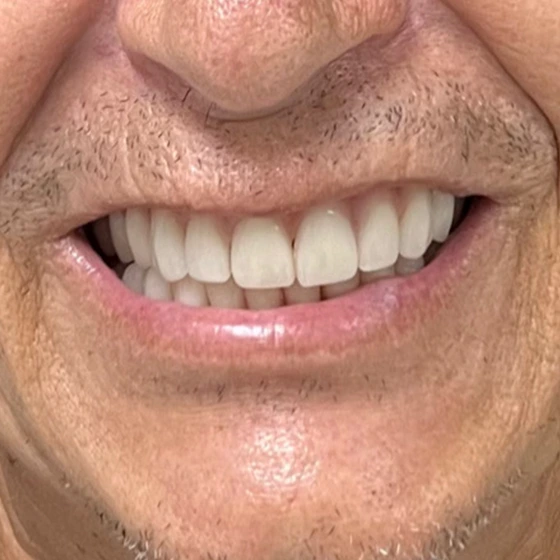 Depois do tratamento odontológico