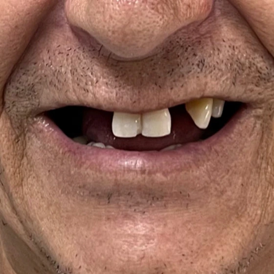 Antes do tratamento odontológico