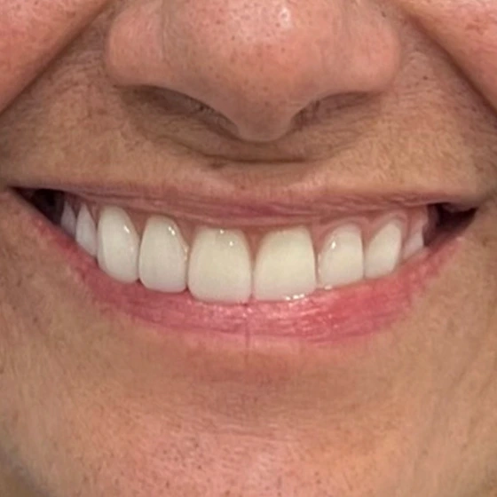Depois do tratamento odontológico