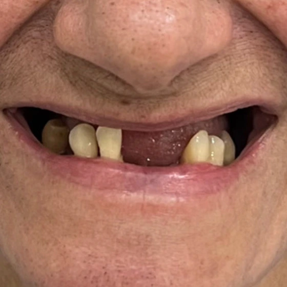 Antes do tratamento odontológico