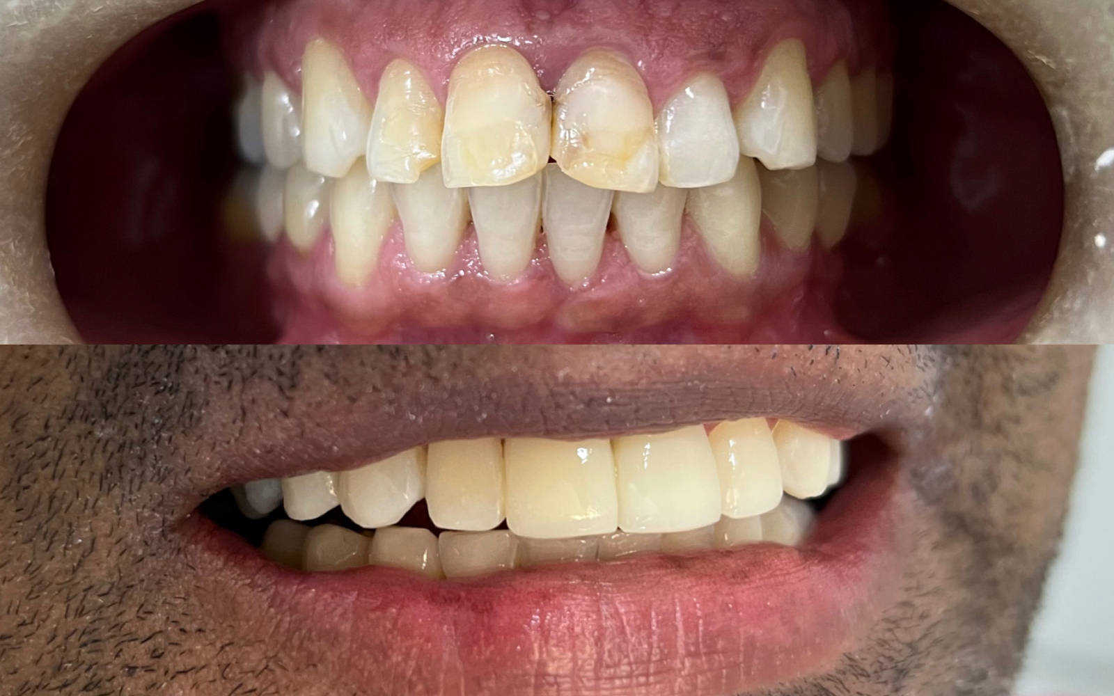 Caso odontológico antes e depois