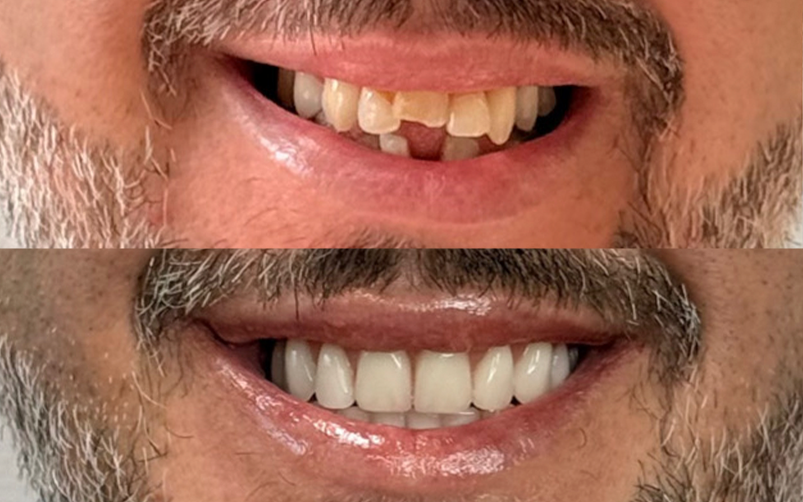 Resultado real de tratamento odontológico