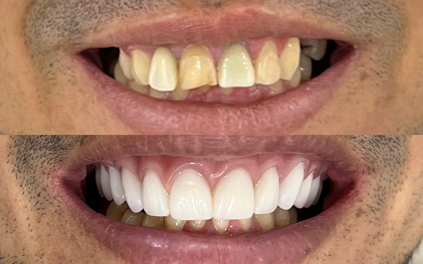Antes e depois de tratamento odontológico