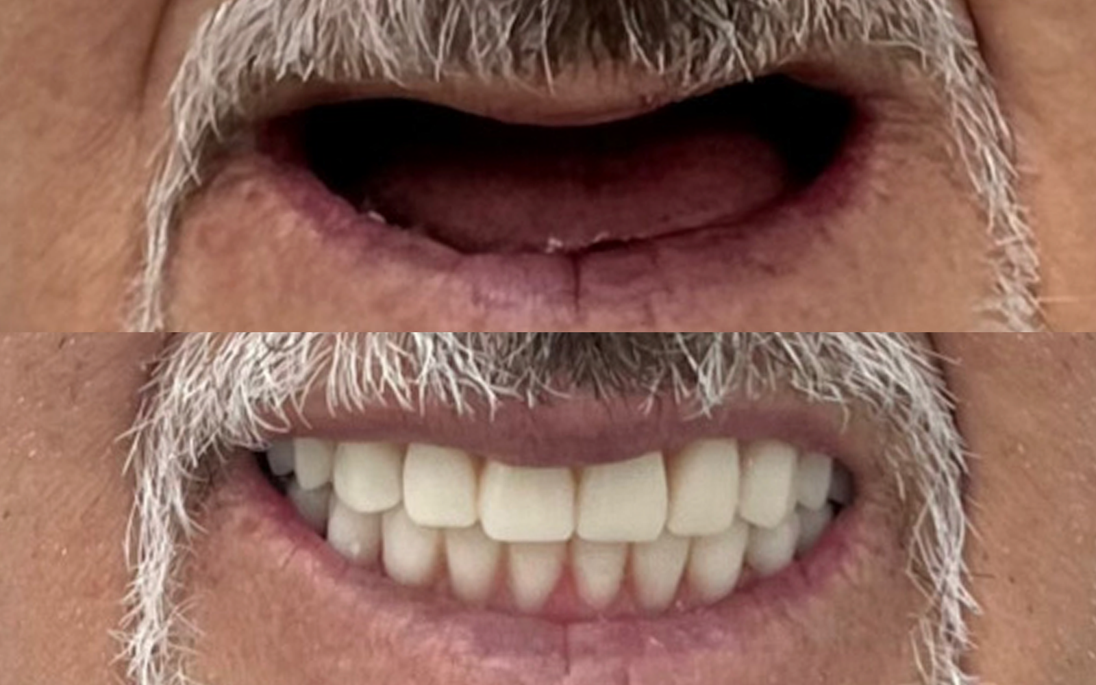 Resultado de reabilitação oral